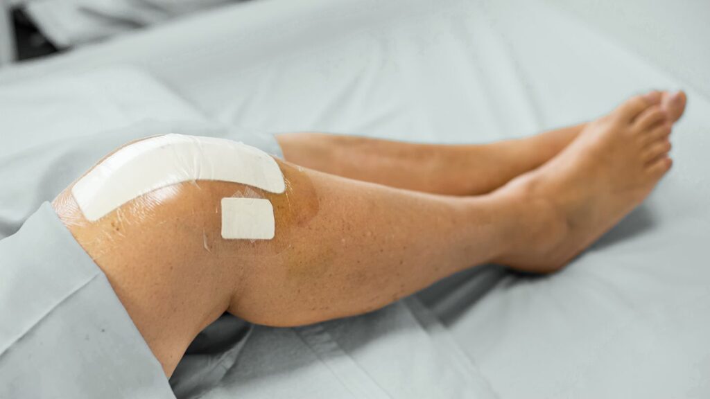 What Are The Complications Associated With Hip And Knee Replacement?