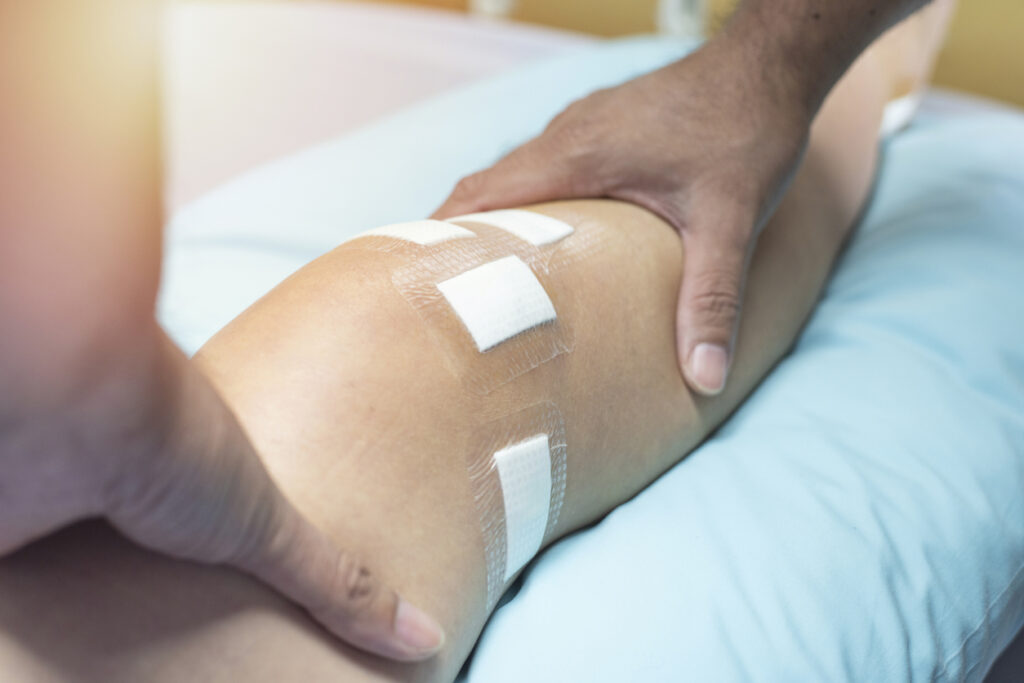 When Does Your ACL Tear Need Surgery?