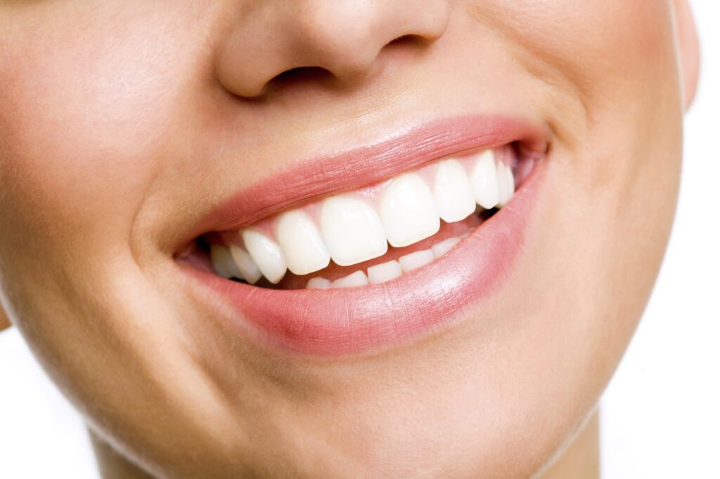 Understanding The Benefits of Teeth Whitening