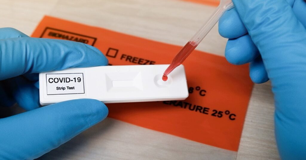 Surprising Reasons Why You Should Get Antibody Testing