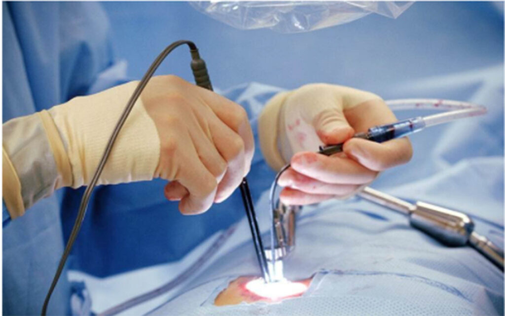 The Benefits of Minimally Invasive Orthopedic Surgery